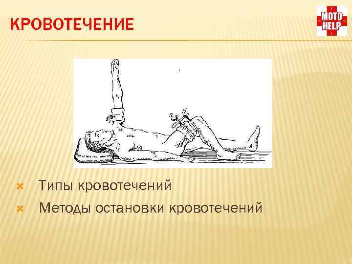КРОВОТЕЧЕНИЕ Типы кровотечений Методы остановки кровотечений 