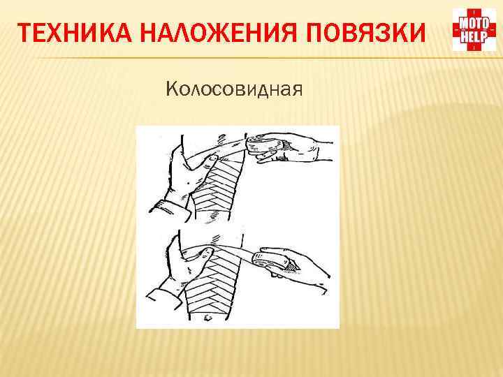 ТЕХНИКА НАЛОЖЕНИЯ ПОВЯЗКИ Колосовидная 
