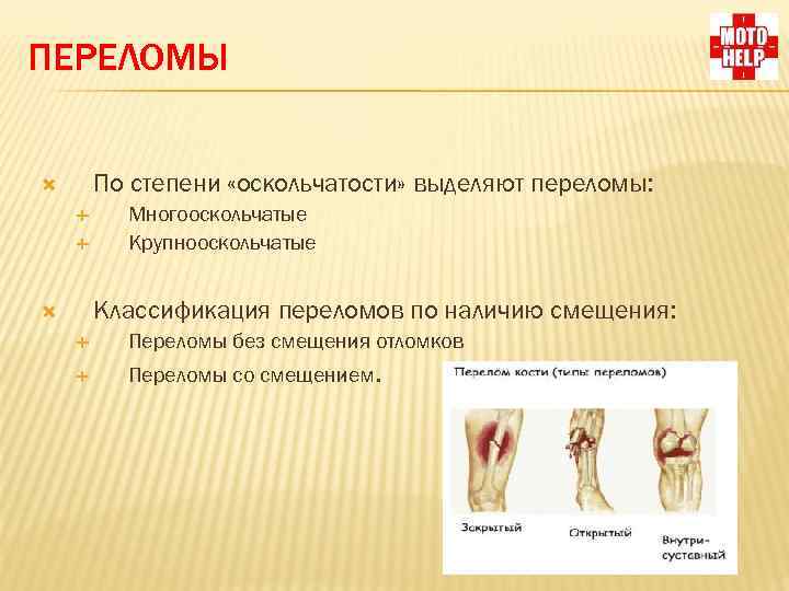 ПЕРЕЛОМЫ По степени «оскольчатости» выделяют переломы: Многооскольчатые Крупнооскольчатые Классификация переломов по наличию смещения: Переломы