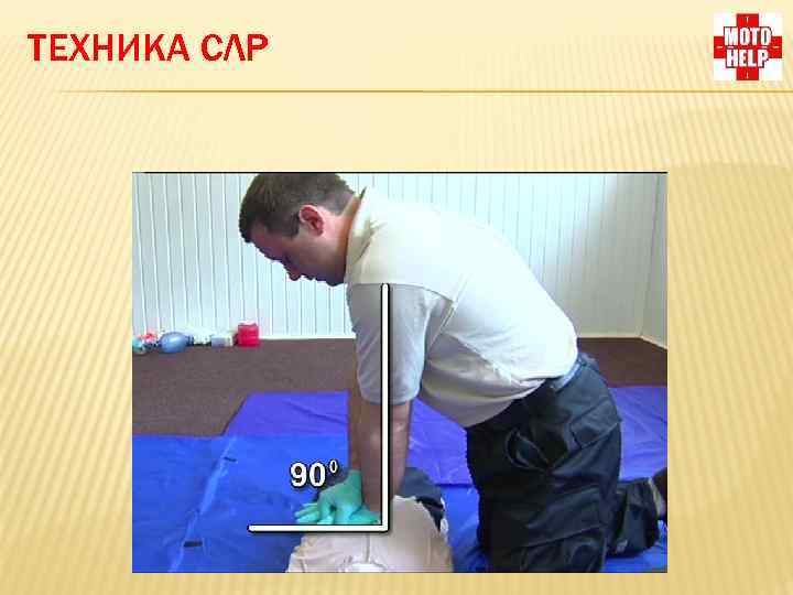 ТЕХНИКА СЛР 