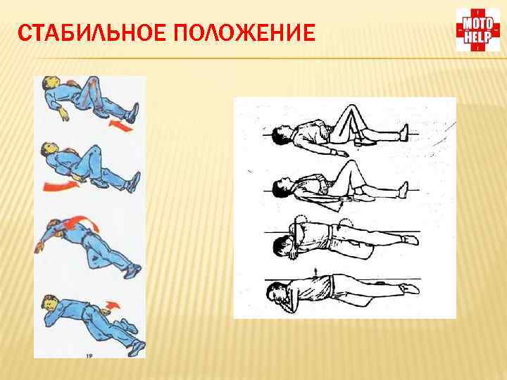 СТАБИЛЬНОЕ ПОЛОЖЕНИЕ 