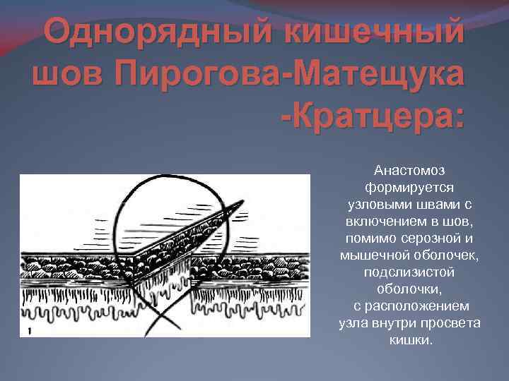 Судьба серозно мышечных узловых кишечных швов при неосложненном заживлении раны кишечной стенки