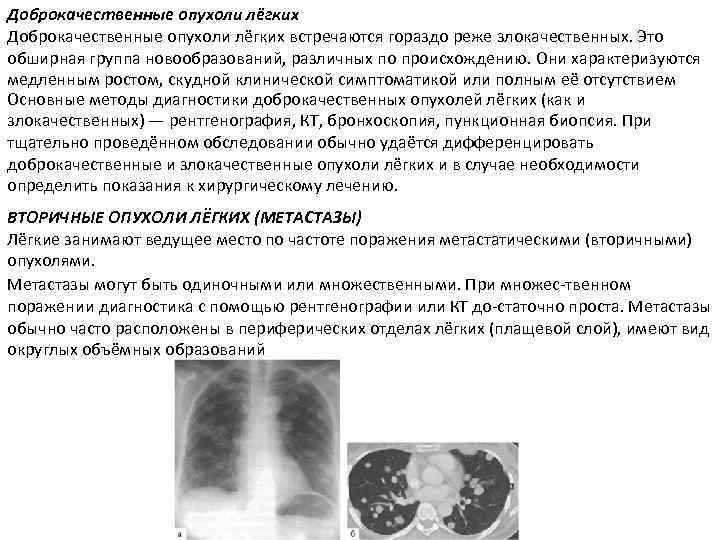 Размеры опухоли легкого