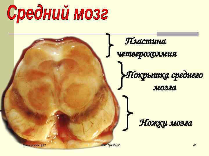 Мозги ноги. Покрышка среднего мозга. Покрышка ножки среднего мозга. Средний мозг покрышка. Покрышка среднего мозга препарат.