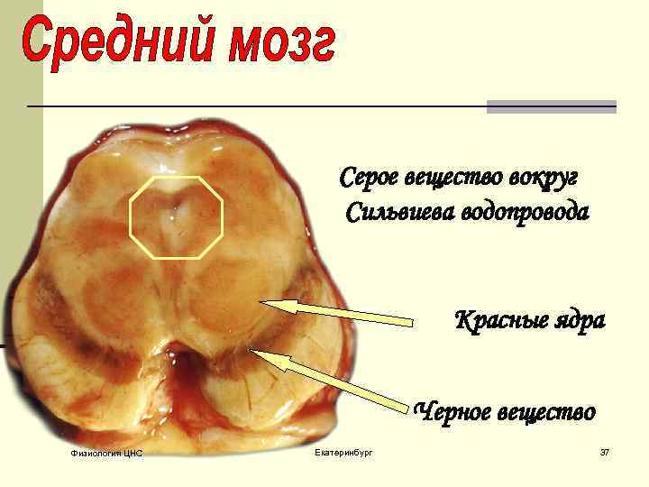 Серое вещество вокруг Сильвиева водопровода Красные ядра Черное вещество Физиология ЦНС Екатеринбург 37 