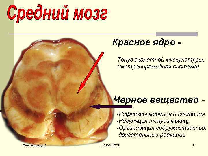 Красное ядро. Красное ядро головного мозга. Средний мозг красное ядро. Черное вещество и красное ядро. Красное ядро и черная субстанция.