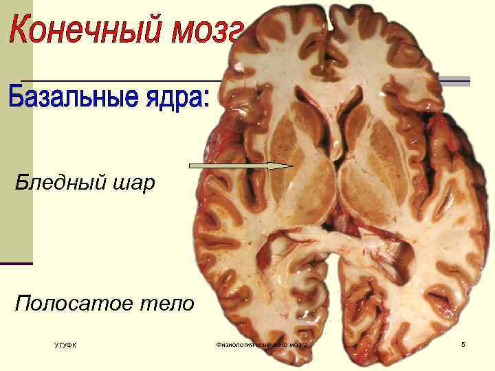 Тело без мозга. Полосатое тело базальные ядра. Полосатое тело мозга.