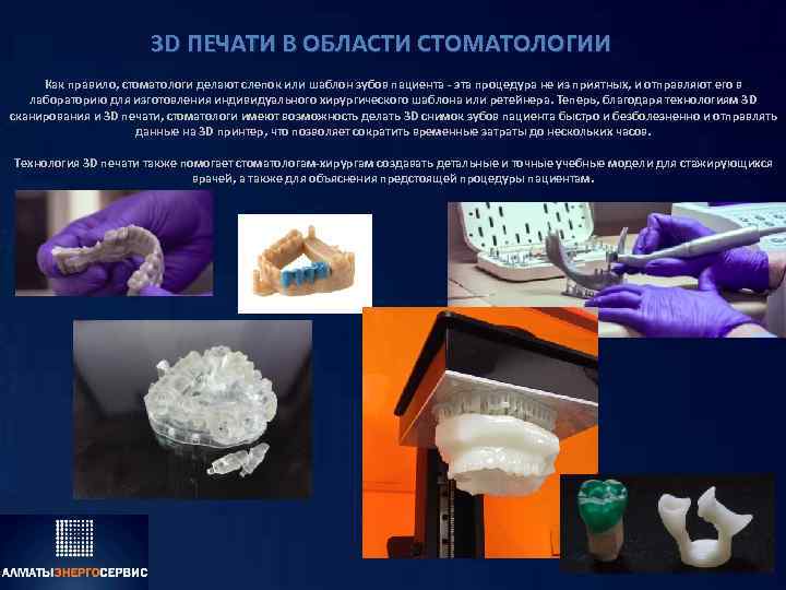 3 D ПЕЧАТИ В ОБЛАСТИ СТОМАТОЛОГИИ Как правило, стоматологи делают слепок или шаблон зубов