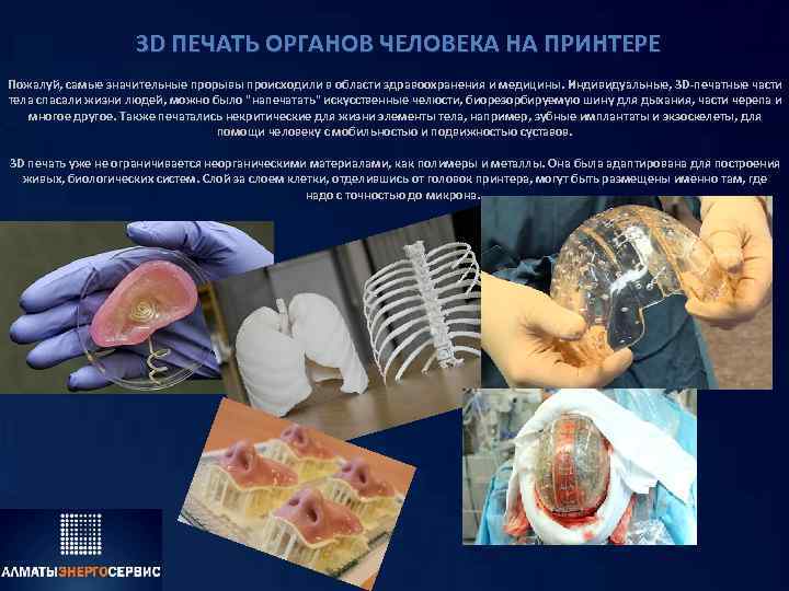 3 D ПЕЧАТЬ ОРГАНОВ ЧЕЛОВЕКА НА ПРИНТЕРЕ Пожалуй, самые значительные прорывы происходили в области