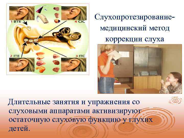 Слухопротезирование- медицинский метод коррекции слуха Длительные занятия и упражнения со слуховыми аппаратами активизируют остаточную