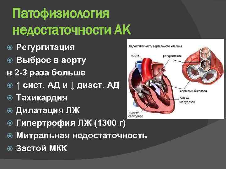 Патофизиология недостаточности АК Регургитация Выброс в аорту в 2 -3 раза больше ↑ сист.