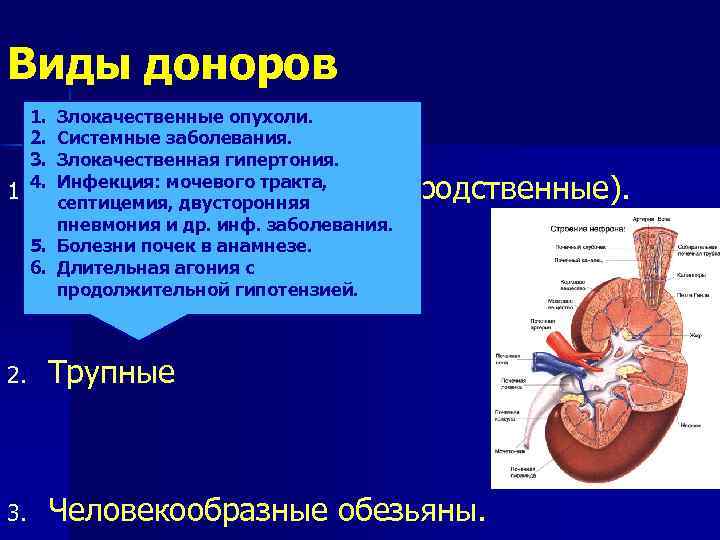 Виды доноров 1. 2. 3. 4. Злокачественные опухоли. Системные заболевания. Злокачественная гипертония. 1. Инфекция: