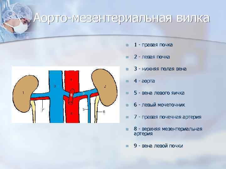 Аорто-мезентериальная вилка n 1 - правая почка n 2 - левая почка n 3