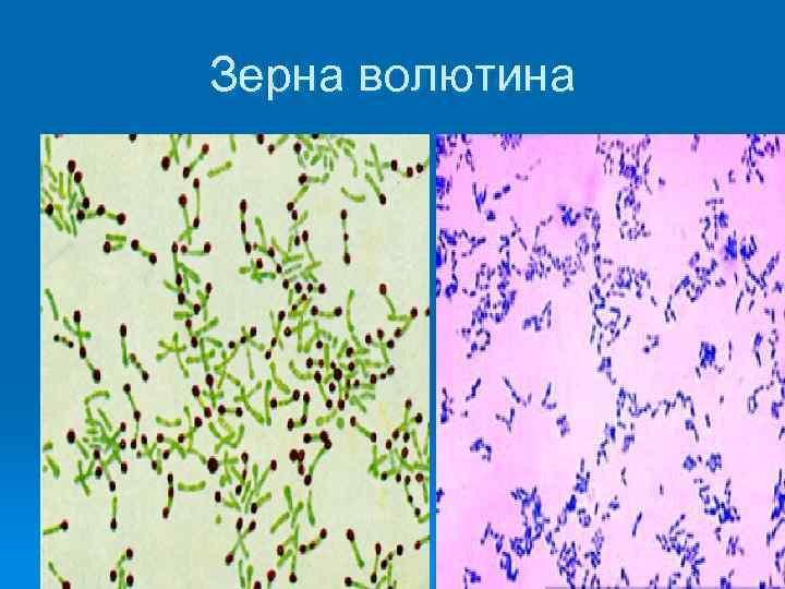 Зерна волютина 