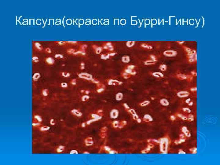 Капсула(окраска по Бурри-Гинсу) 