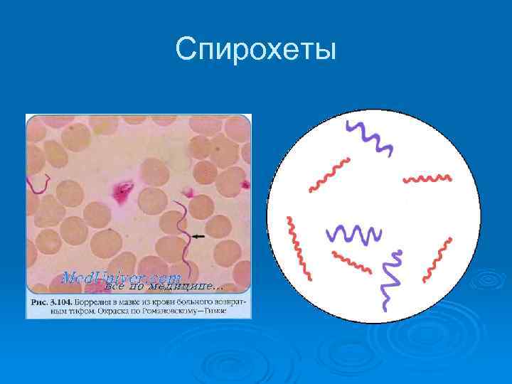 Спирохеты 