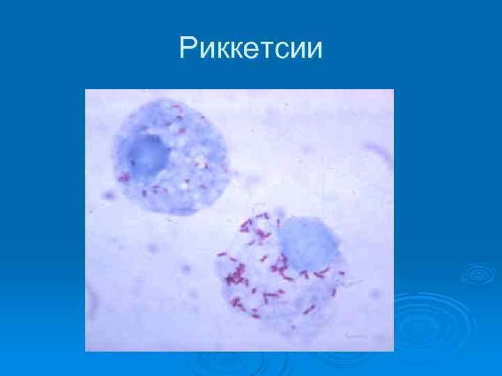 Риккетсии 