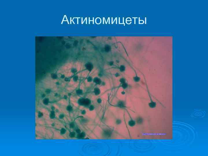 Актиномицеты 