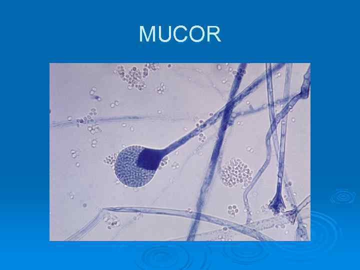 MUCOR 