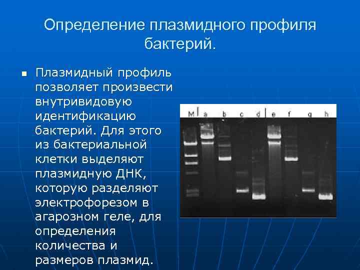 Определение плазмидного профиля бактерий. n Плазмидный профиль позволяет произвести внутривидовую идентификацию бактерий. Для этого