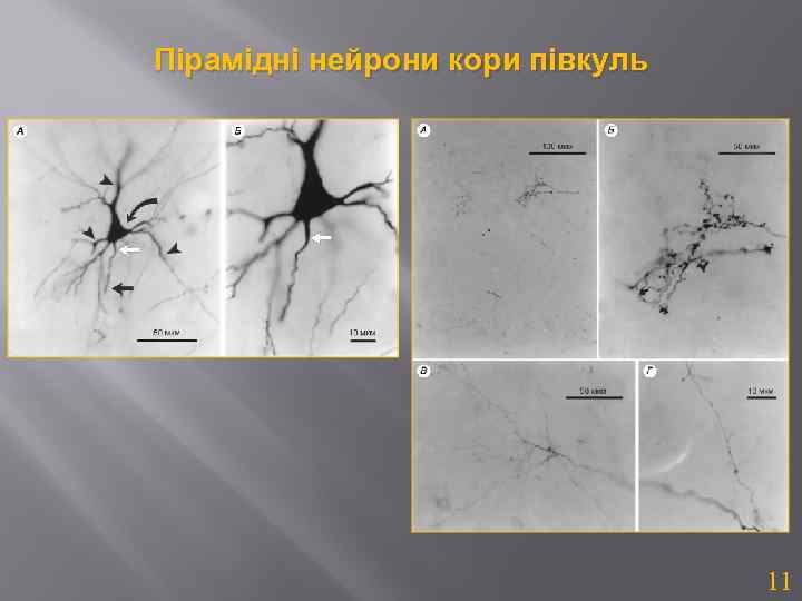 Пірамідні нейрони кори півкуль 11 
