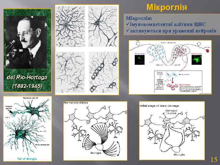 Мікроглія: üімунокомпетентні клітини ЦНС üактивуються при ураженні нейронів 15 