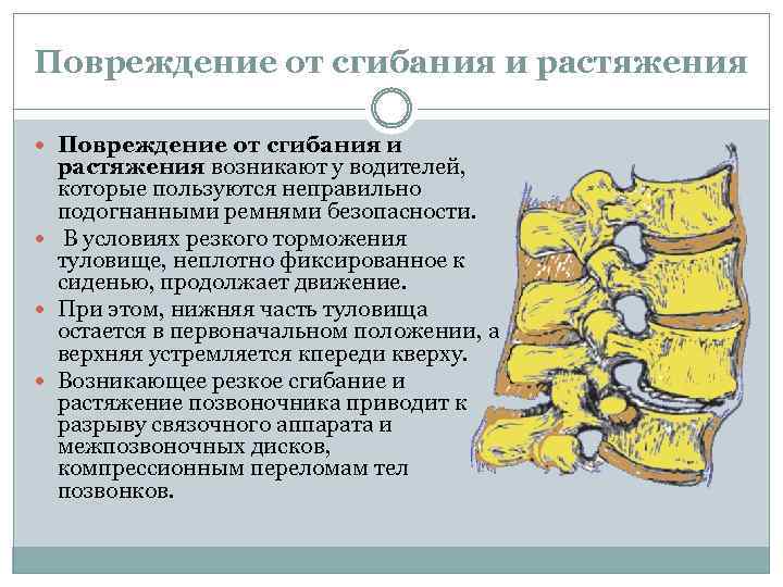 Повреждение от сгибания и растяжения Повреждение от сгибания и растяжения возникают у водителей, которые