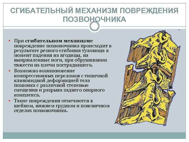 СГИБАТЕЛЬНЫЙ МЕХАНИЗМ ПОВРЕЖДЕНИЯ ПОЗВОНОЧНИКА При сгибательном механизме повреждение позвоночника происходит в результате резкого сгибания