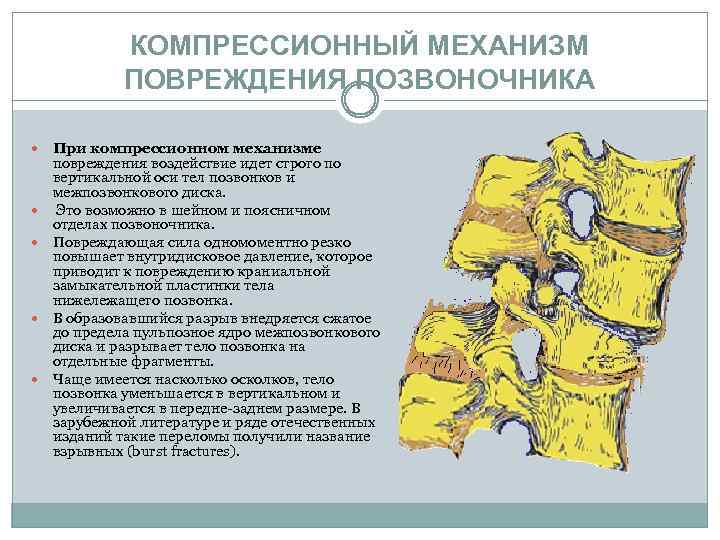 Переломы позвоночника презентация