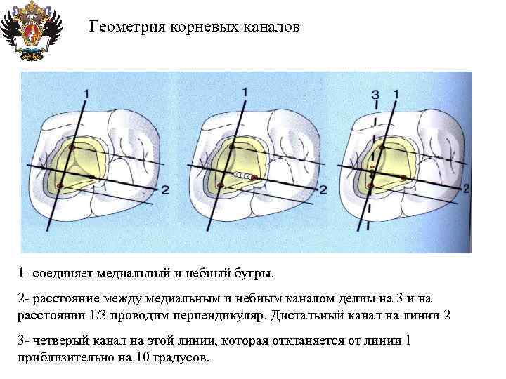 Геометрия корневых каналов 1 - соединяет медиальный и небный бугры. 2 - расстояние между