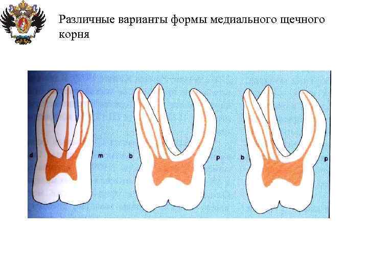 Анатомия корневых каналов презентация