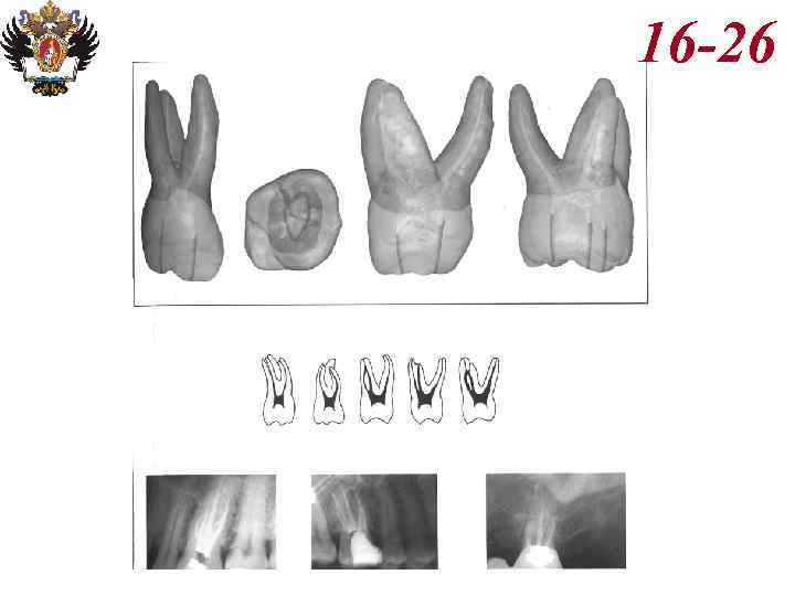Анатомия корневых каналов презентация