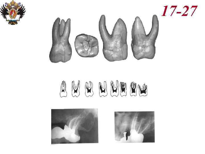 Анатомия корневых каналов презентация