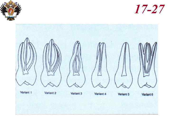 Анатомия корневых каналов презентация