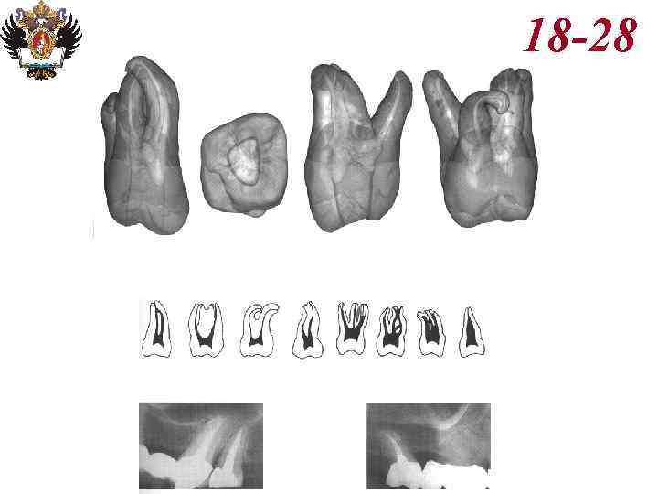 Анатомия корневых каналов презентация