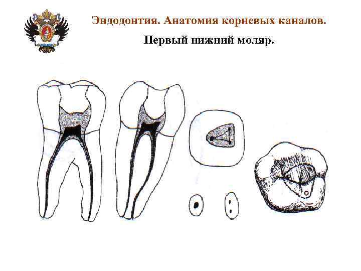 Анатомия корневых каналов презентация