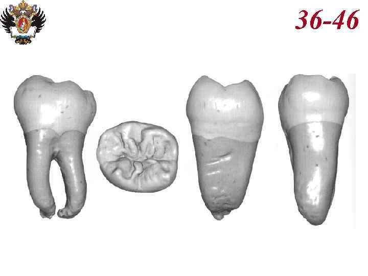 Анатомия корневых каналов презентация