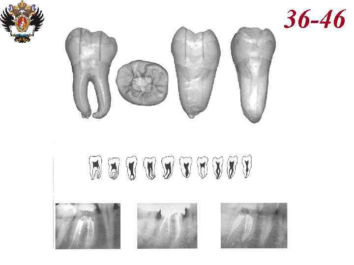 Анатомия корневых каналов презентация