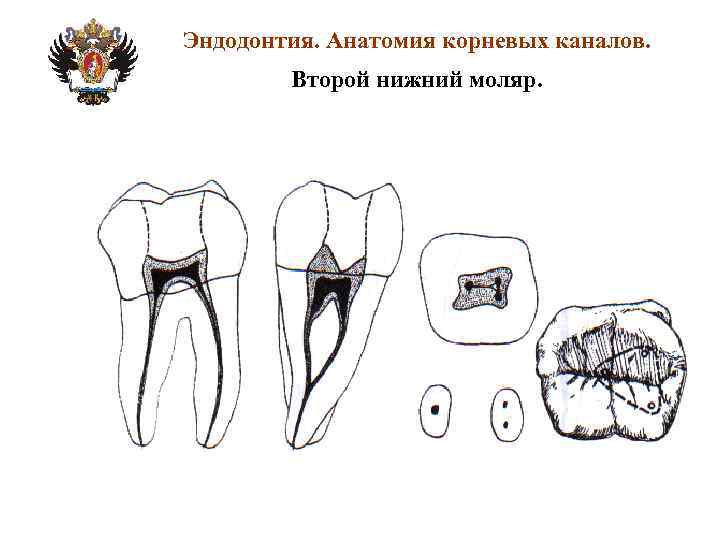 Анатомия корневых каналов презентация