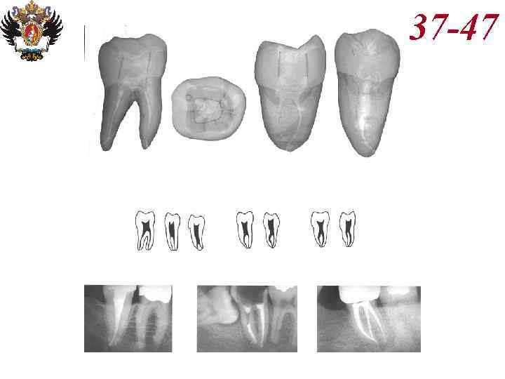 Анатомия корневых каналов презентация