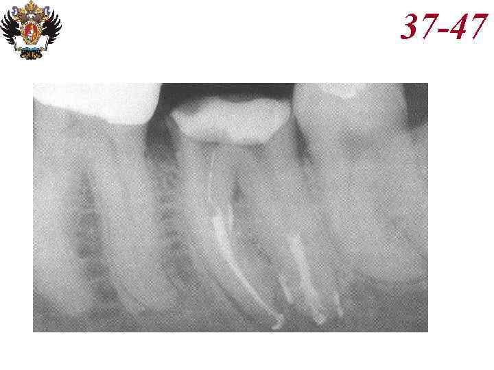 Анатомия корневых каналов презентация