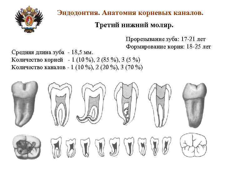 Схема корневых каналов