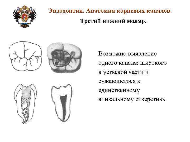 Анатомия корневых каналов презентация