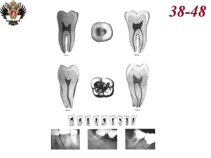 Анатомия корневых каналов презентация
