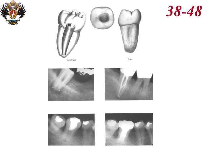 Анатомия корневых каналов презентация