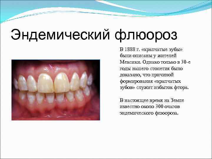 Эндемический флюороз В 1888 г. «крапчатые зубы» были описаны у жителей Мексики. Однако только