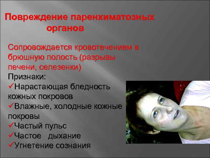 Повреждение паренхиматозных органов Сопровождается кровотечением в брюшную полость (разрывы печени, селезенки) Признаки: üНарастающая бледность