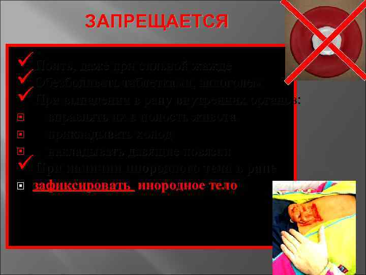 ЗАПРЕЩАЕТСЯ üПоить, даже при сильной жажде üОбезболивать таблетками, алкоголем üПри выпадении в рану внутренних