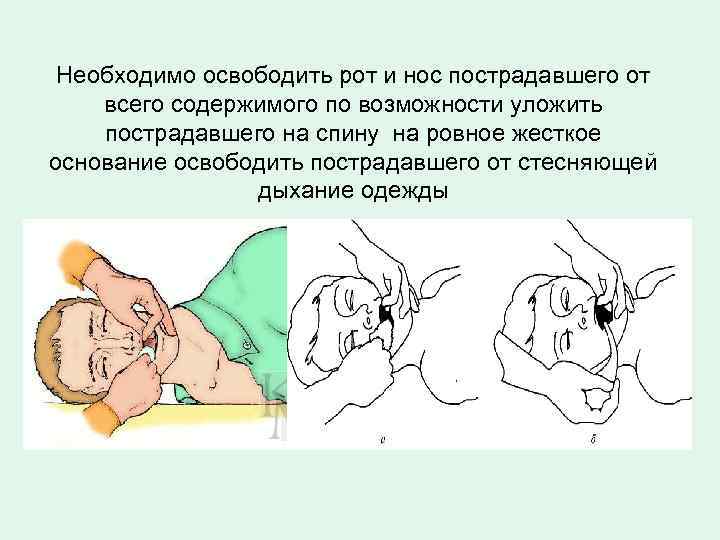 Реанимация непрямой массаж сердца. Проведение непрямого массажа сердца и безвентиляционной реанимации. Дыхание рот в рот и непрямой массаж. Правила проведения непрямого массажа сердца и безвентиляционной. Непрямой массаж сердца рот в нос.