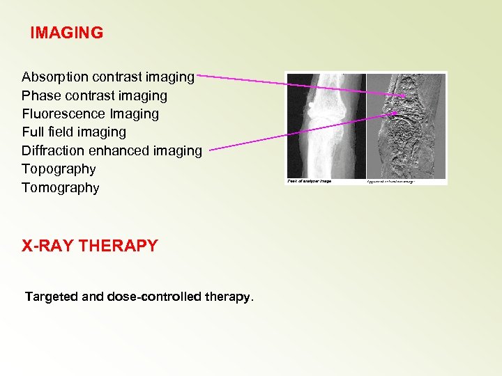 IMAGING Absorption contrast imaging Phase contrast imaging Fluorescence Imaging Full field imaging Diffraction enhanced